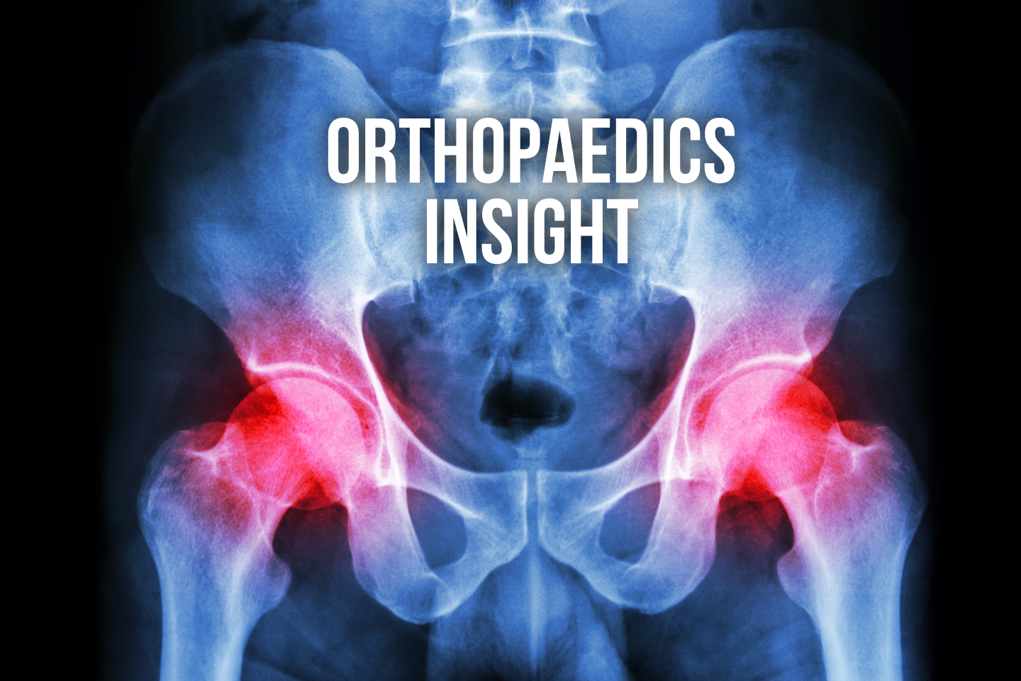 Therapy Insights: Orthopaedics – Making No Bones About It